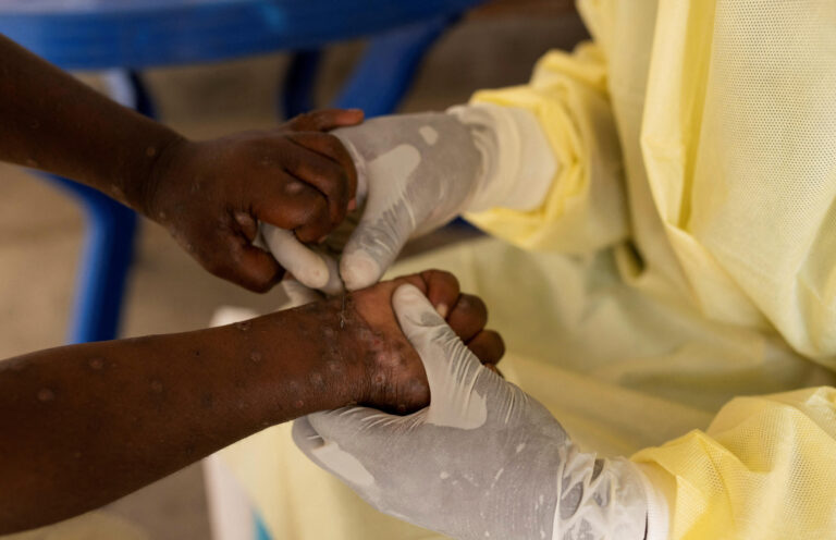 L’épidémie de Mpox a déjà fait 866 morts en Afrique