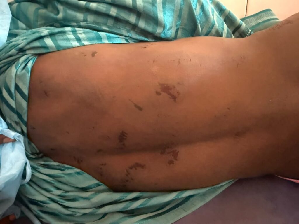 Siguiri: une fillette de 18 mois grièvement blessée aux lèvres après avoir été mordue par son père